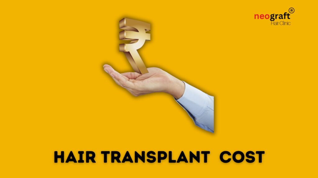 Cost Of Hair Transplant in Chandigarh