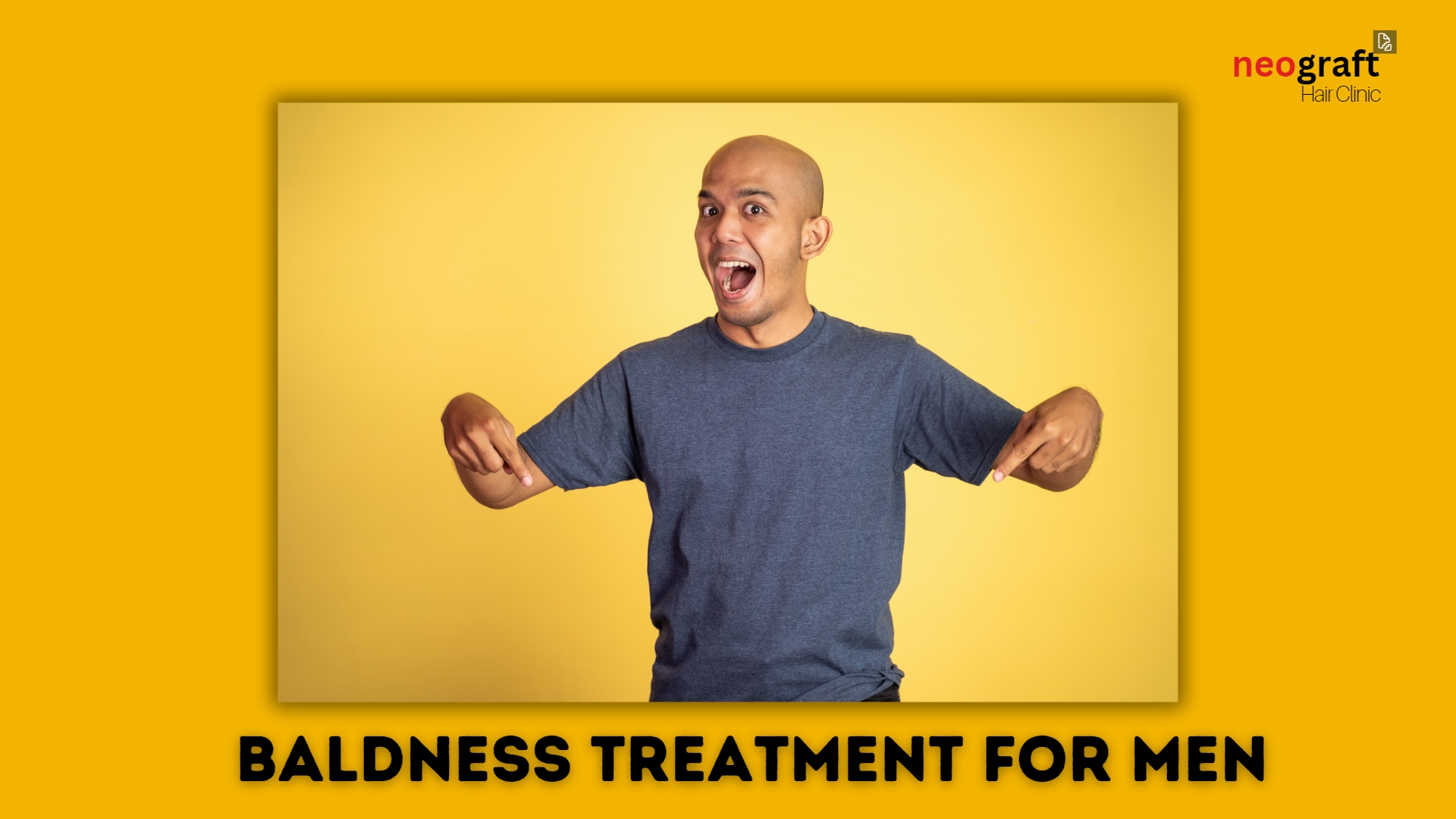baldness treatment for men