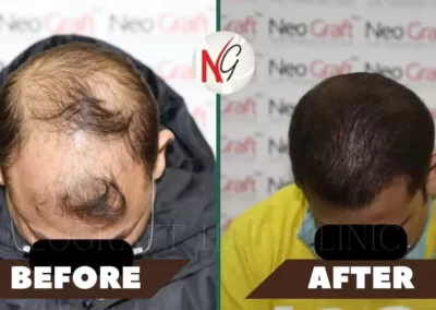 Before After Hair