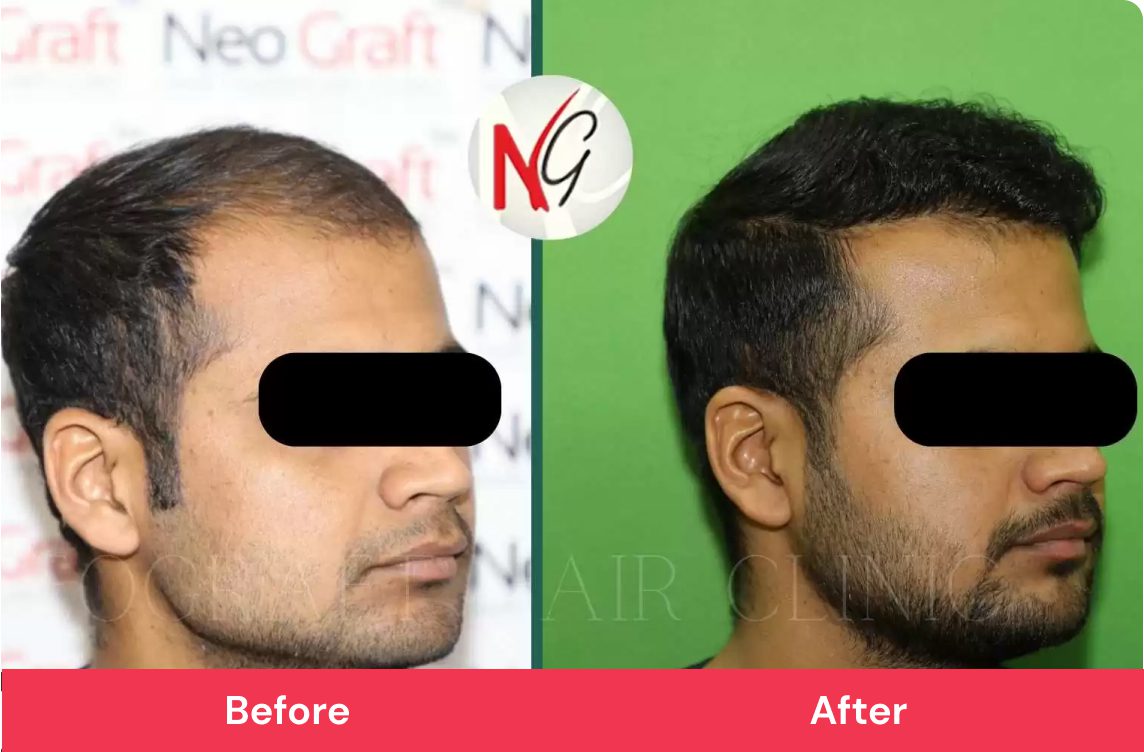 Hair Loss Protocol