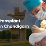 hair transplant cost in chandigarh