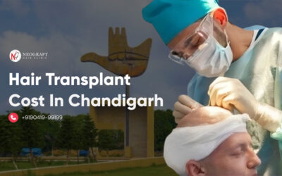 Hair transplant cost in Chandigarh