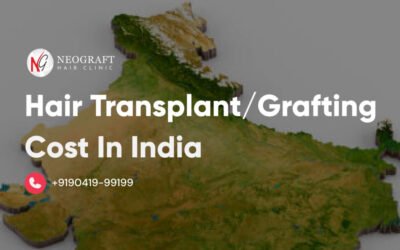 Hair Transplant / Grafting Cost in India