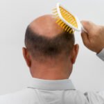 NeoPlatinum Hair Transplant Recovery Timeline: What to Expect Post-Procedure