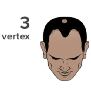 Grade 3V