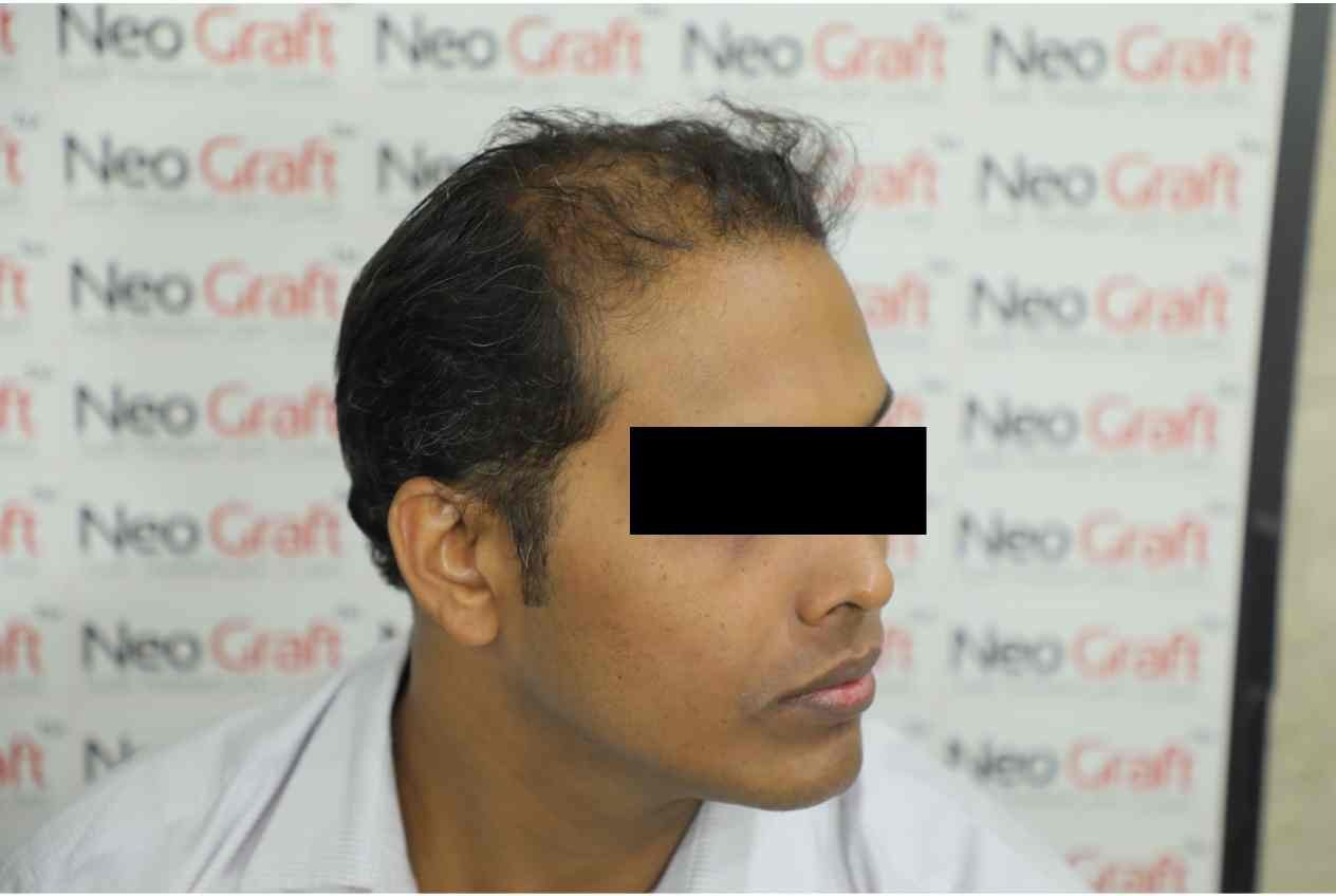 Before