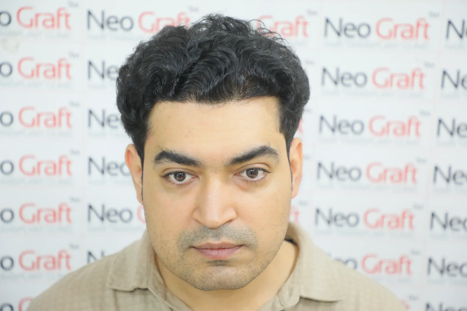 2500-graft NeoDHT® client story — After