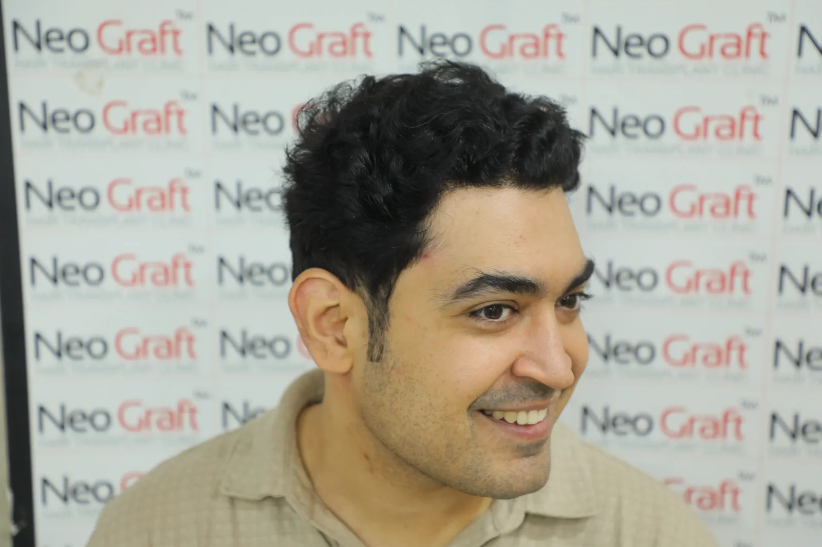 2500-graft NeoDHT® client story — result angle 3
